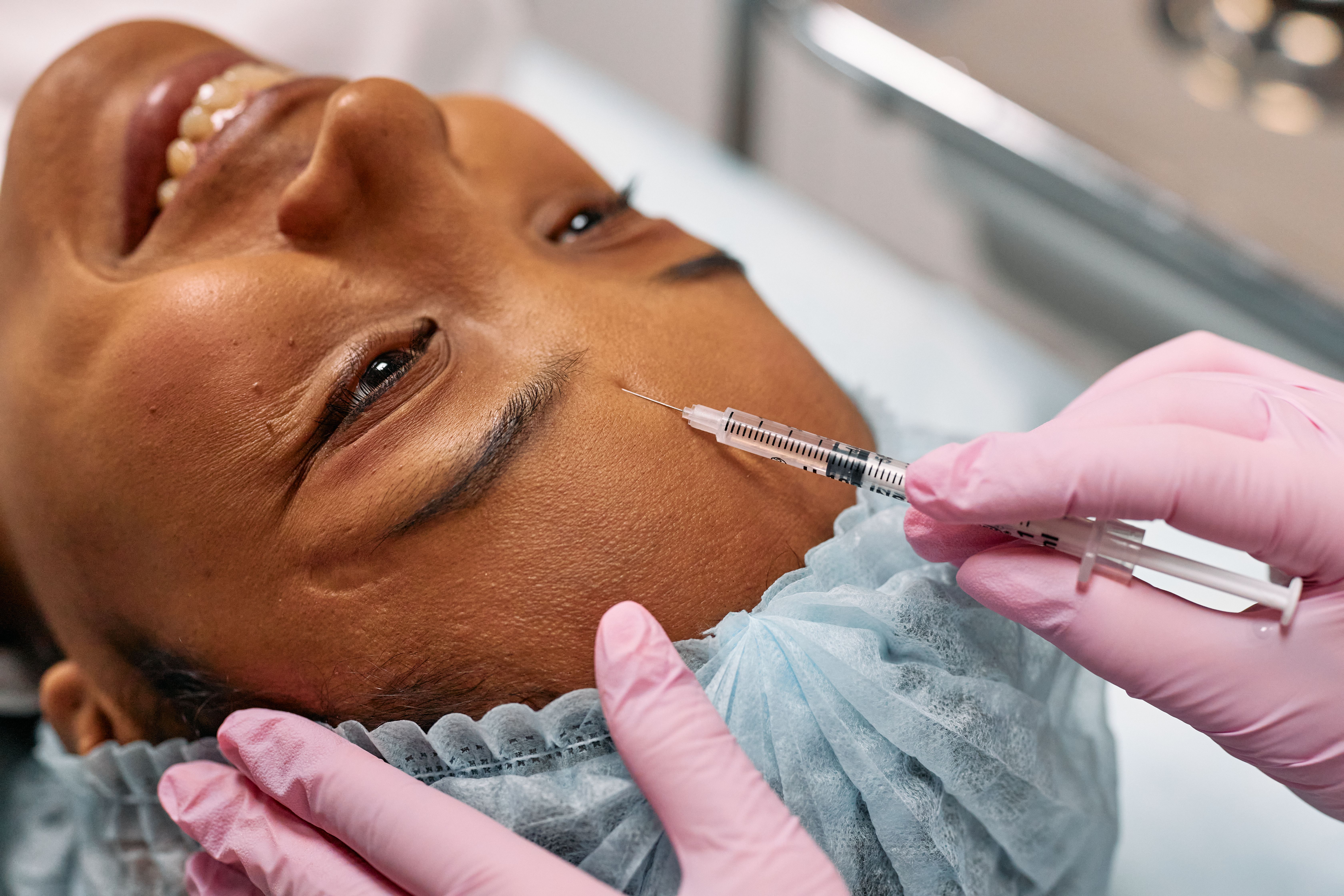 Botox treatment Irvine