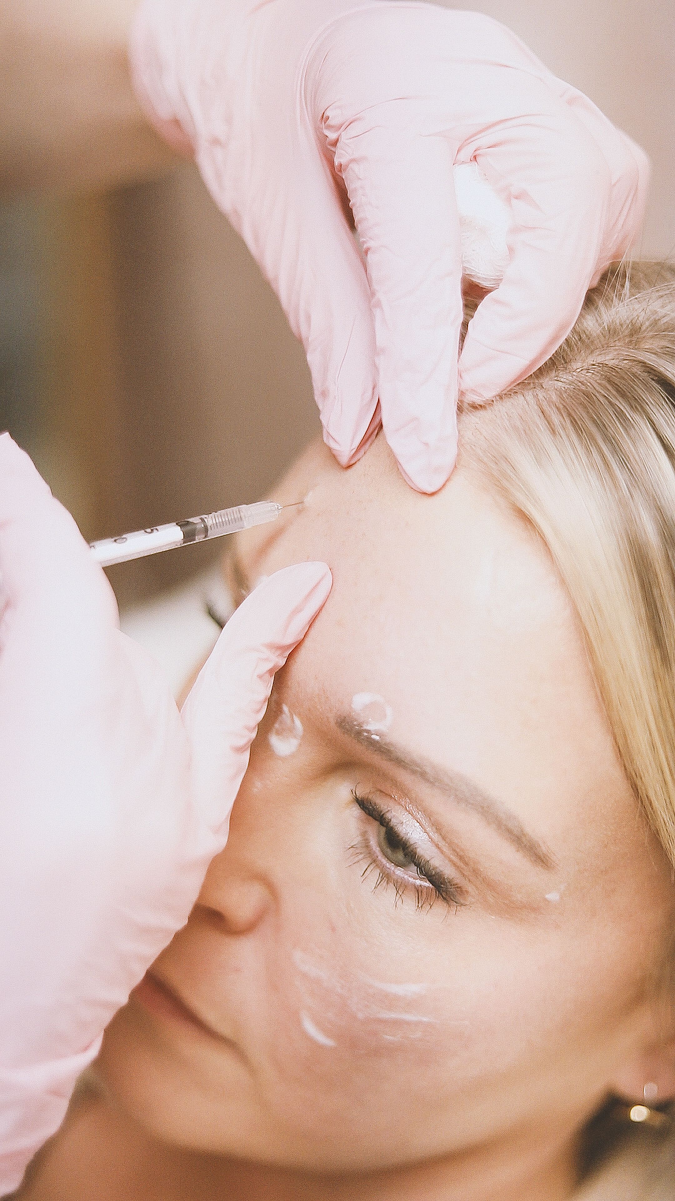 Neurotoxin treatment at Aurevia