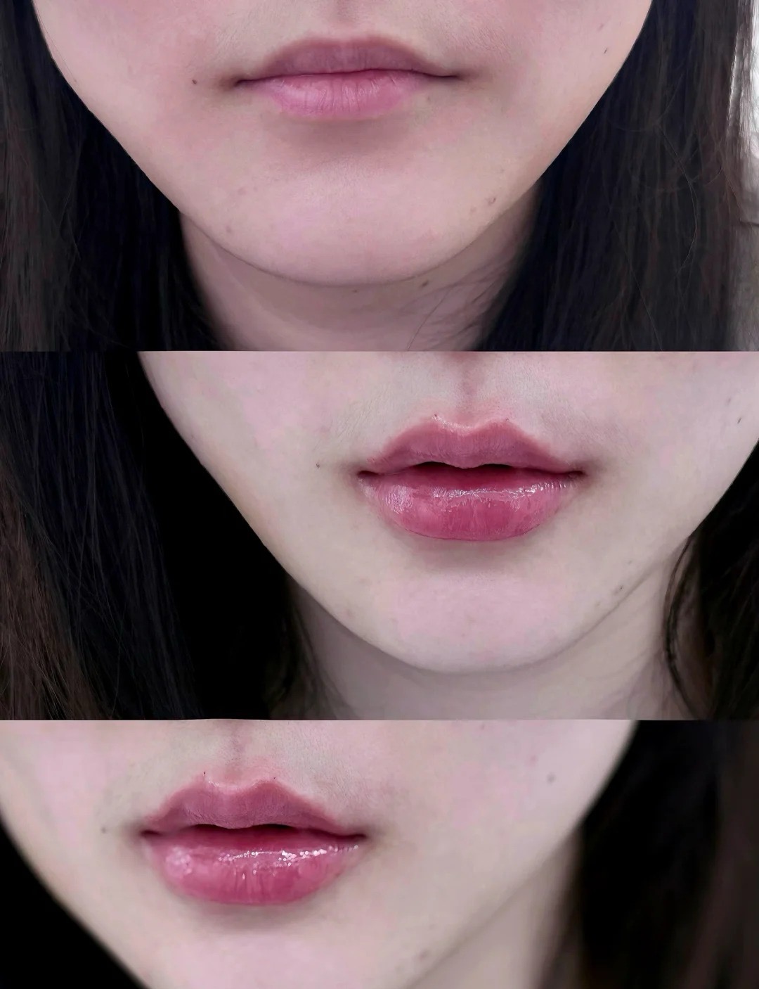 Before / After 1