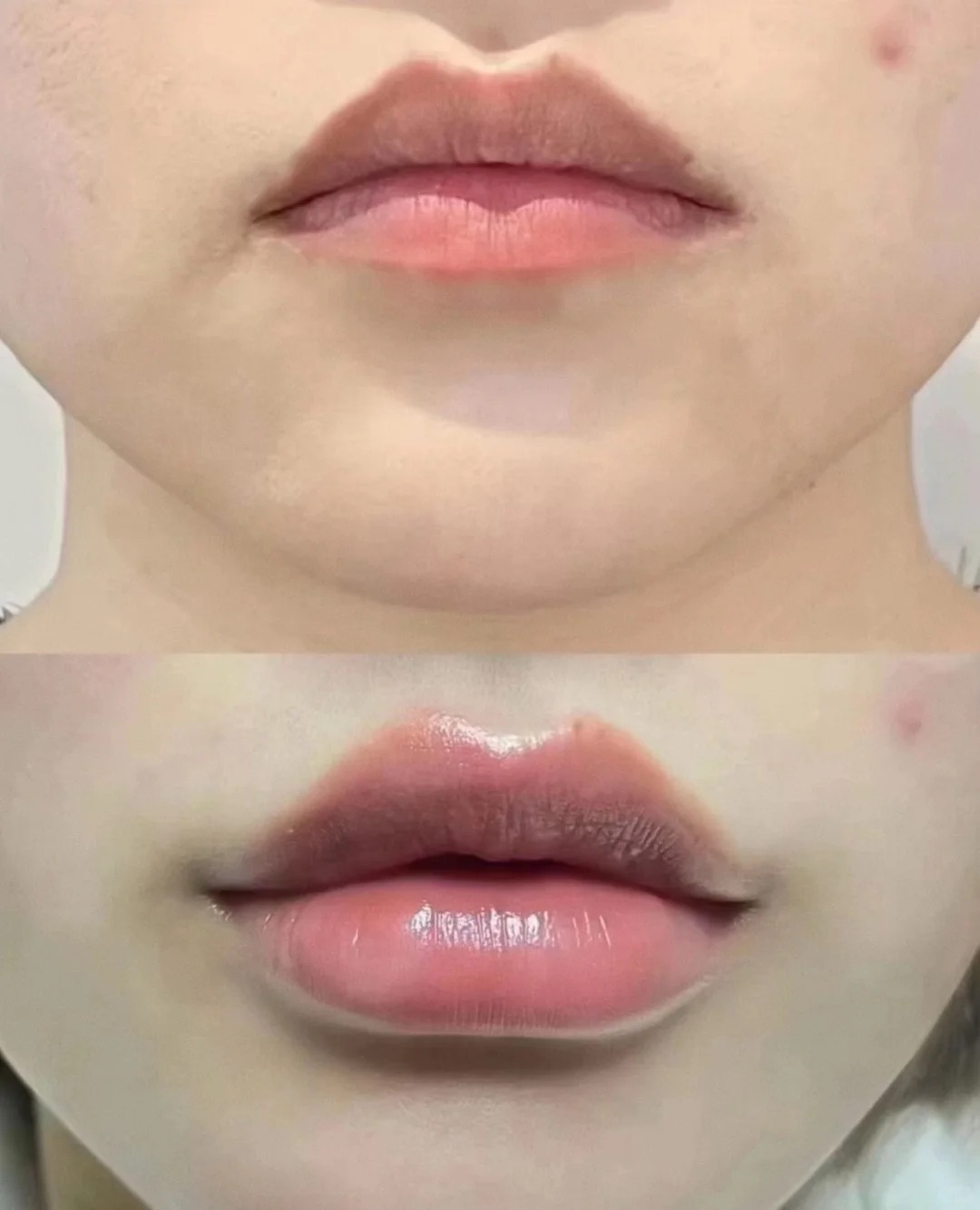 Before / After 2