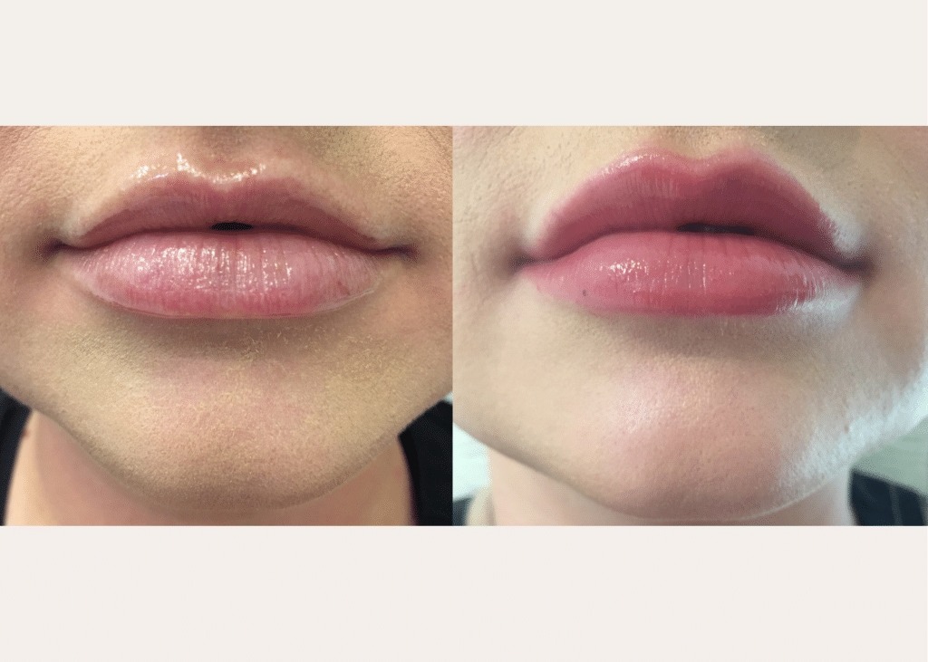 Before / After 3