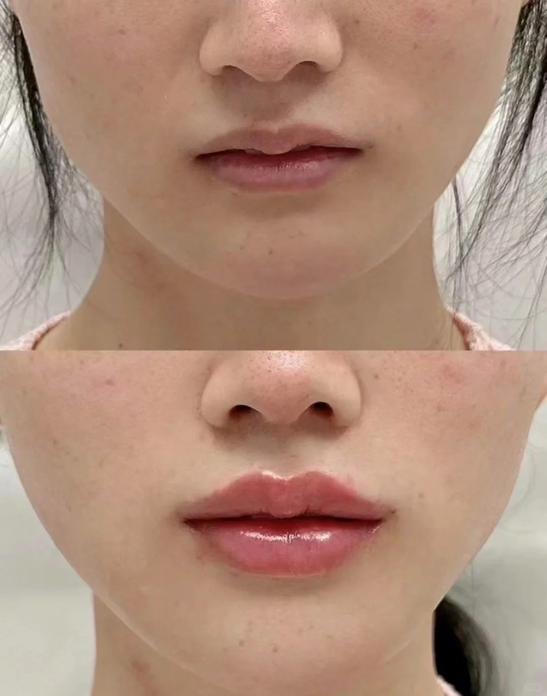 Before / After 4