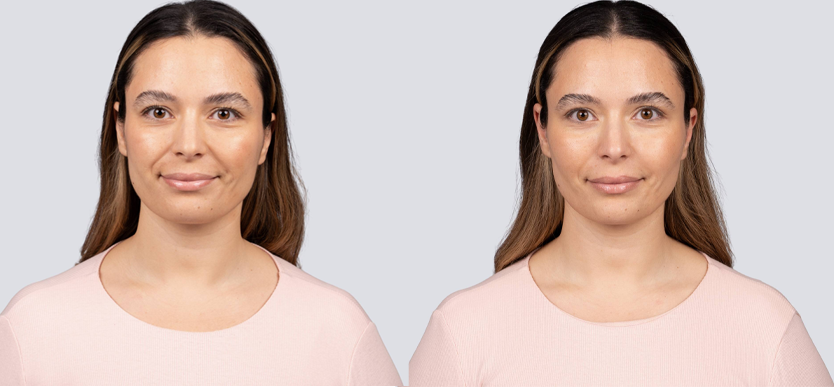 Before / After 1