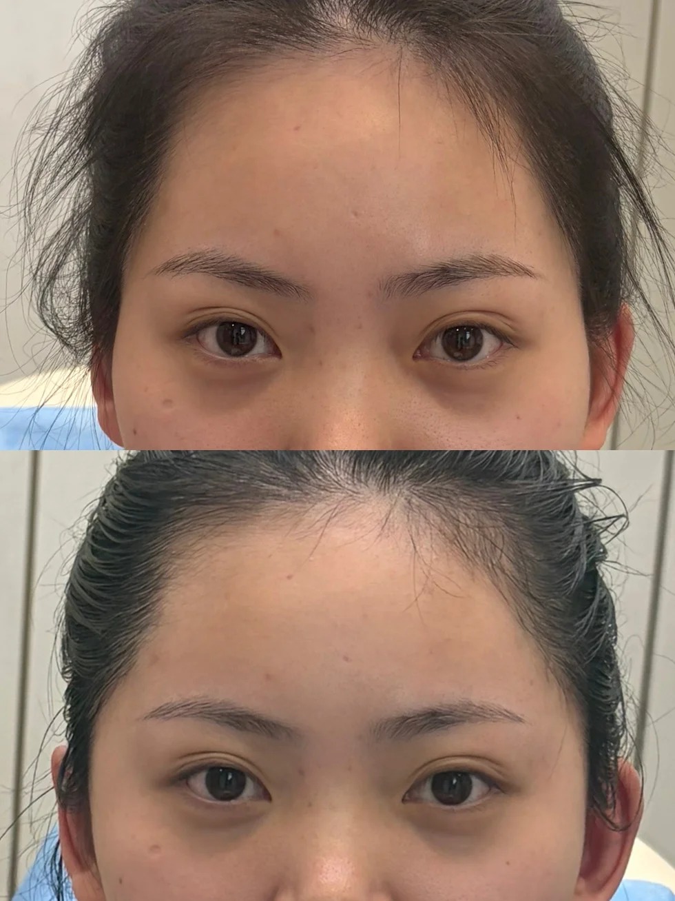 Before / After 2