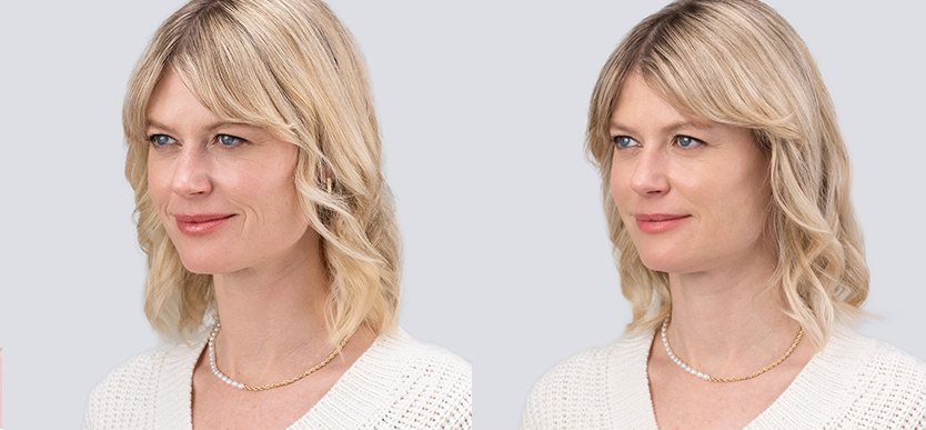 Before / After 3