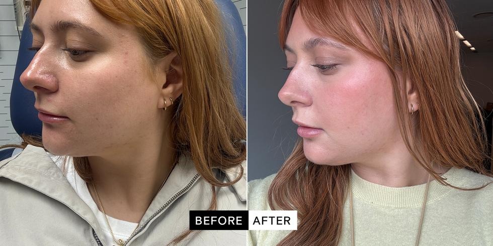 Before / After 4