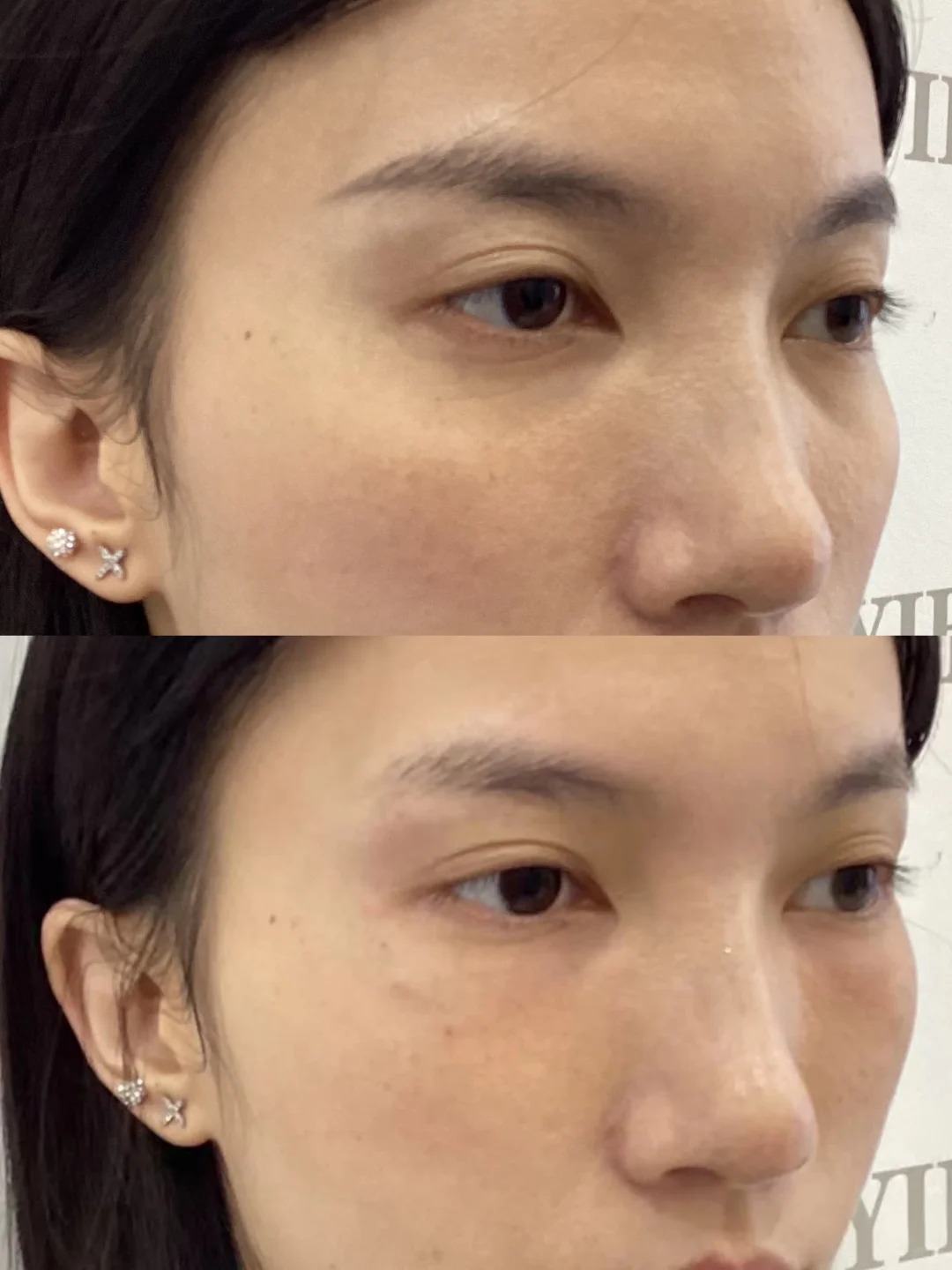Before / After 2