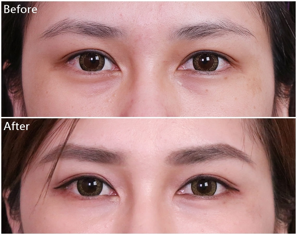 Before / After 3