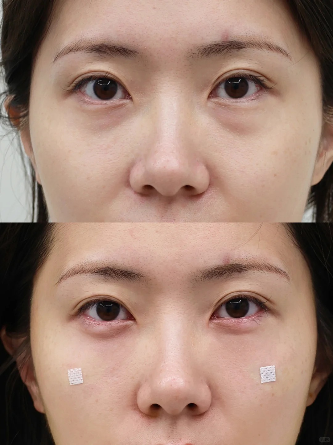 Before / After 5