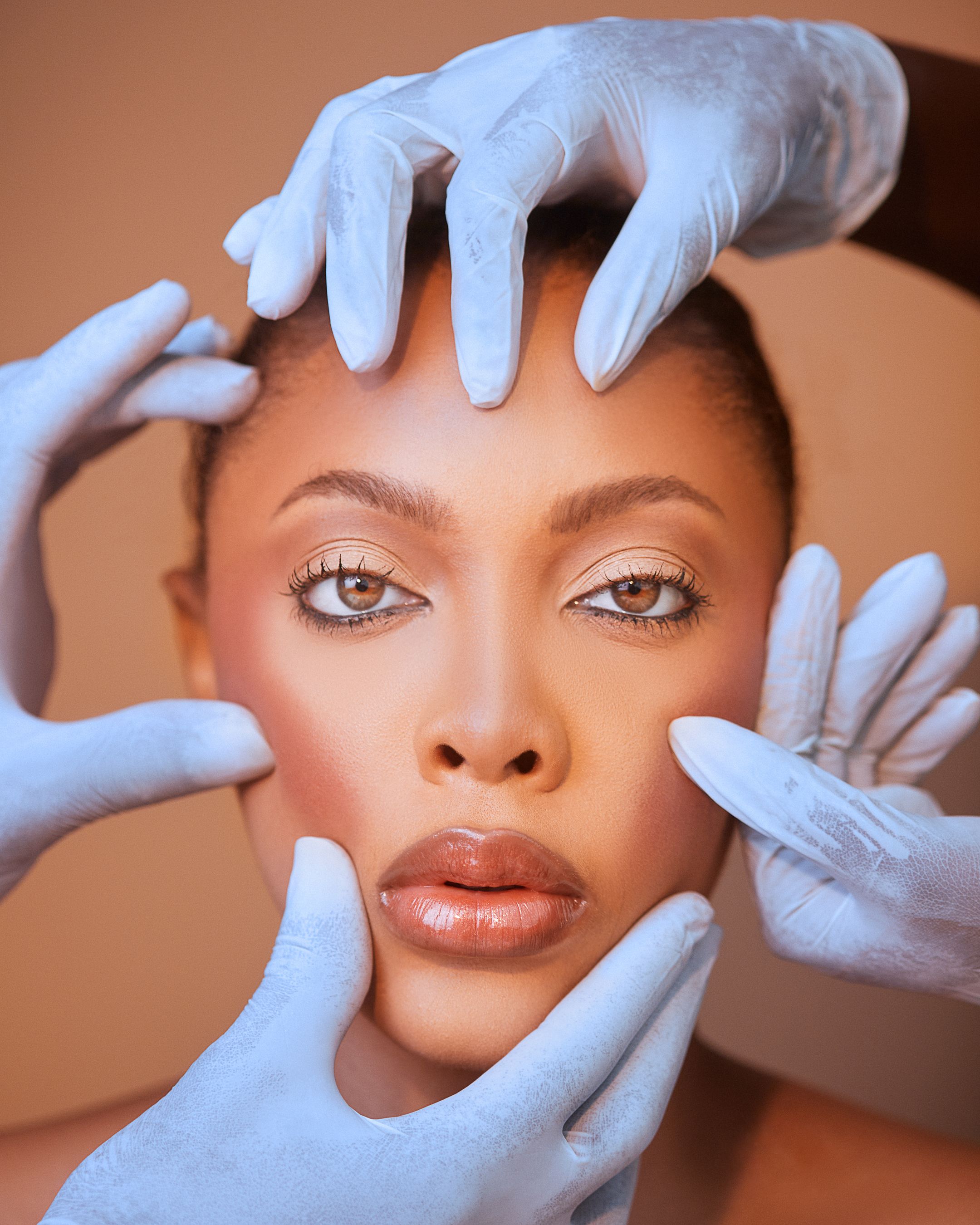 Irvine Dysport model at Aurevia Skincare