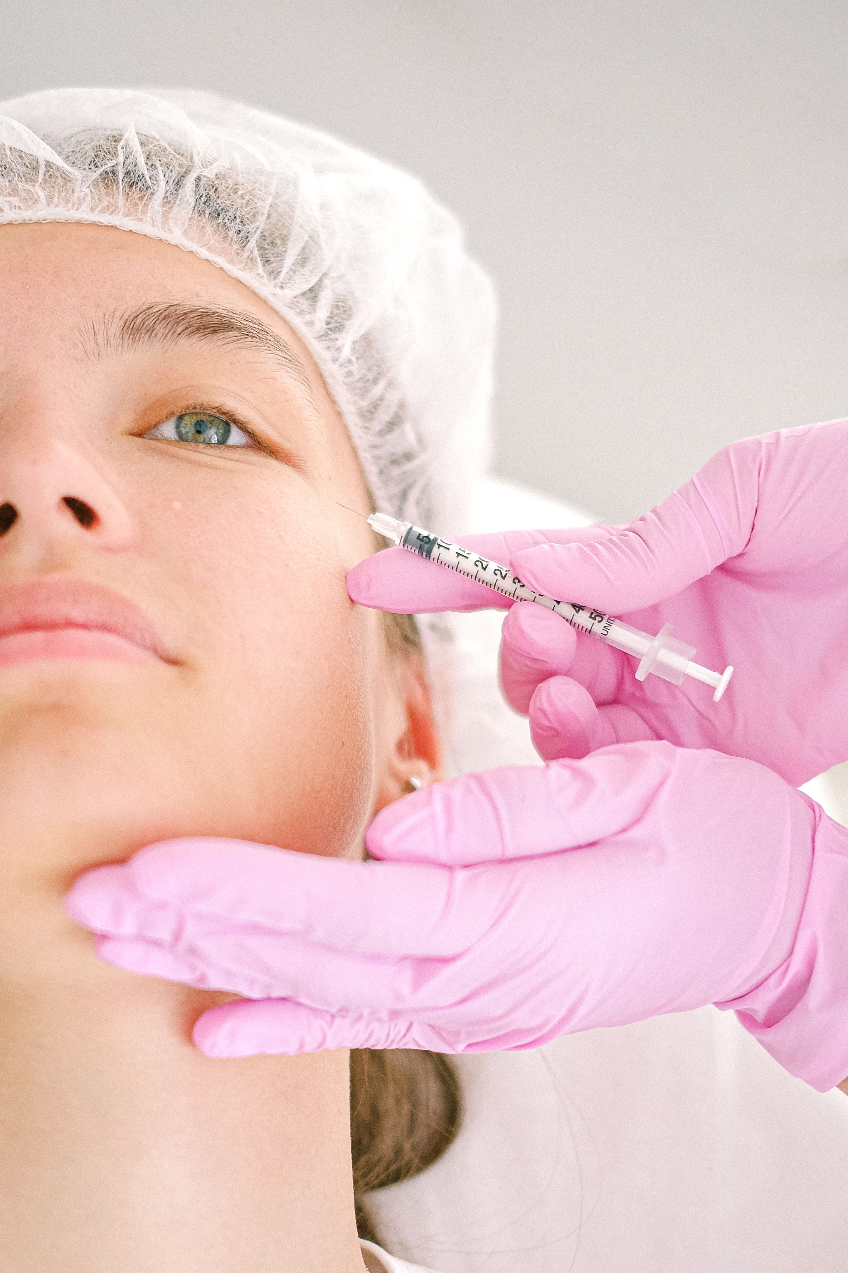 Irvine Jeuveau patient — refreshed, natural results