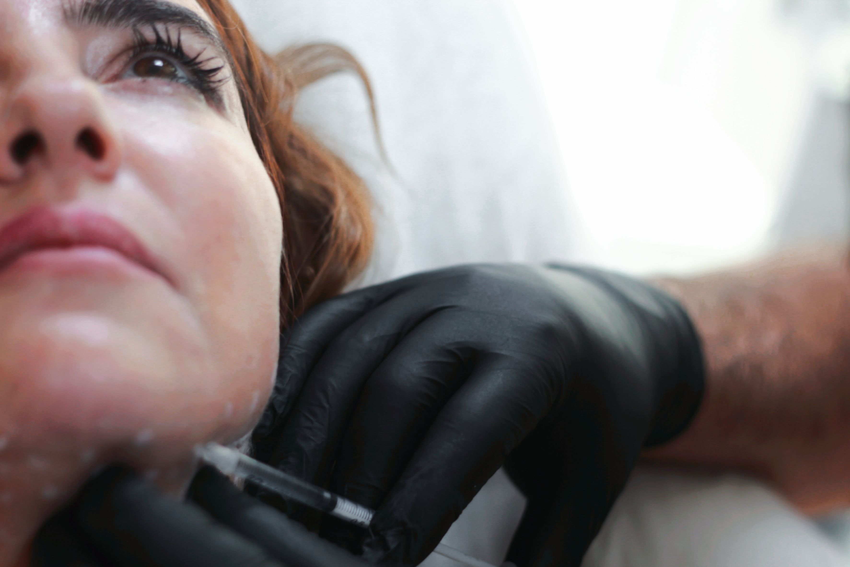 Deoxycholic acid submental injection