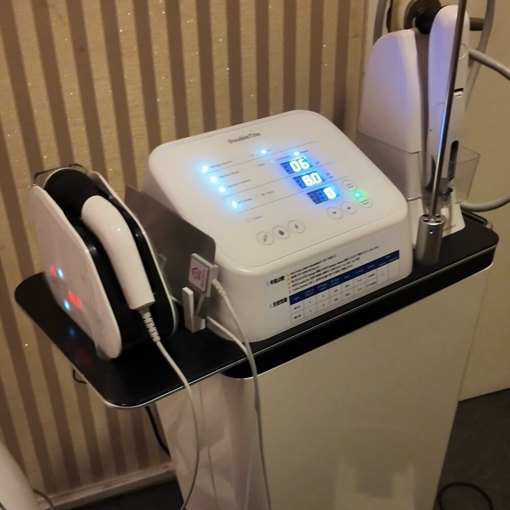 PRP microneedling treatment